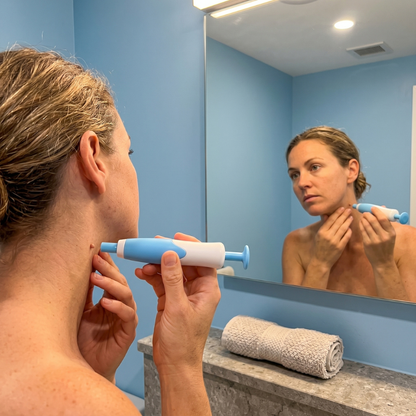 ClearWay™ MicroTech Skin Tag Remover